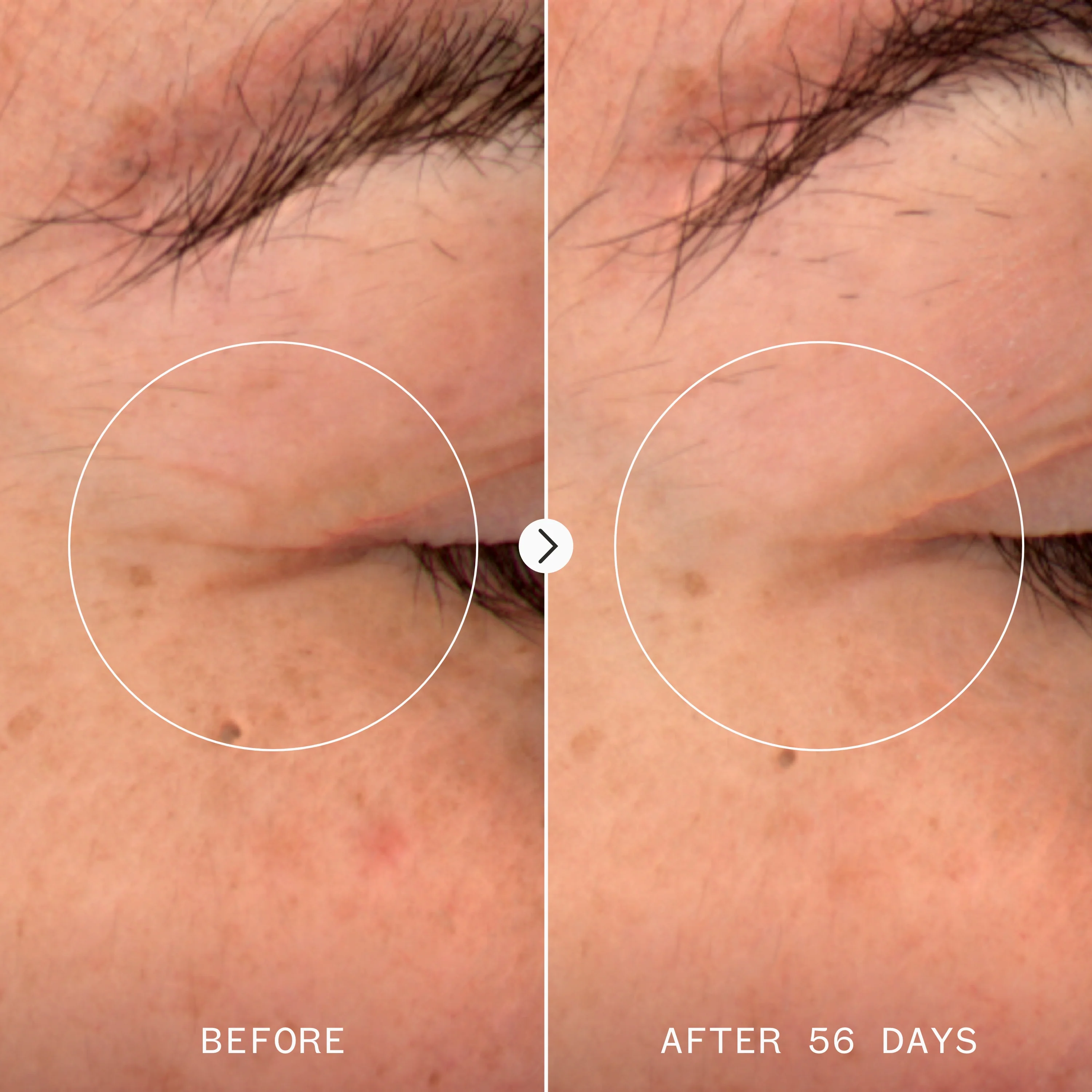 Age Confidence™ NAD+ & TriPeptide Renewal Serum - Image 4