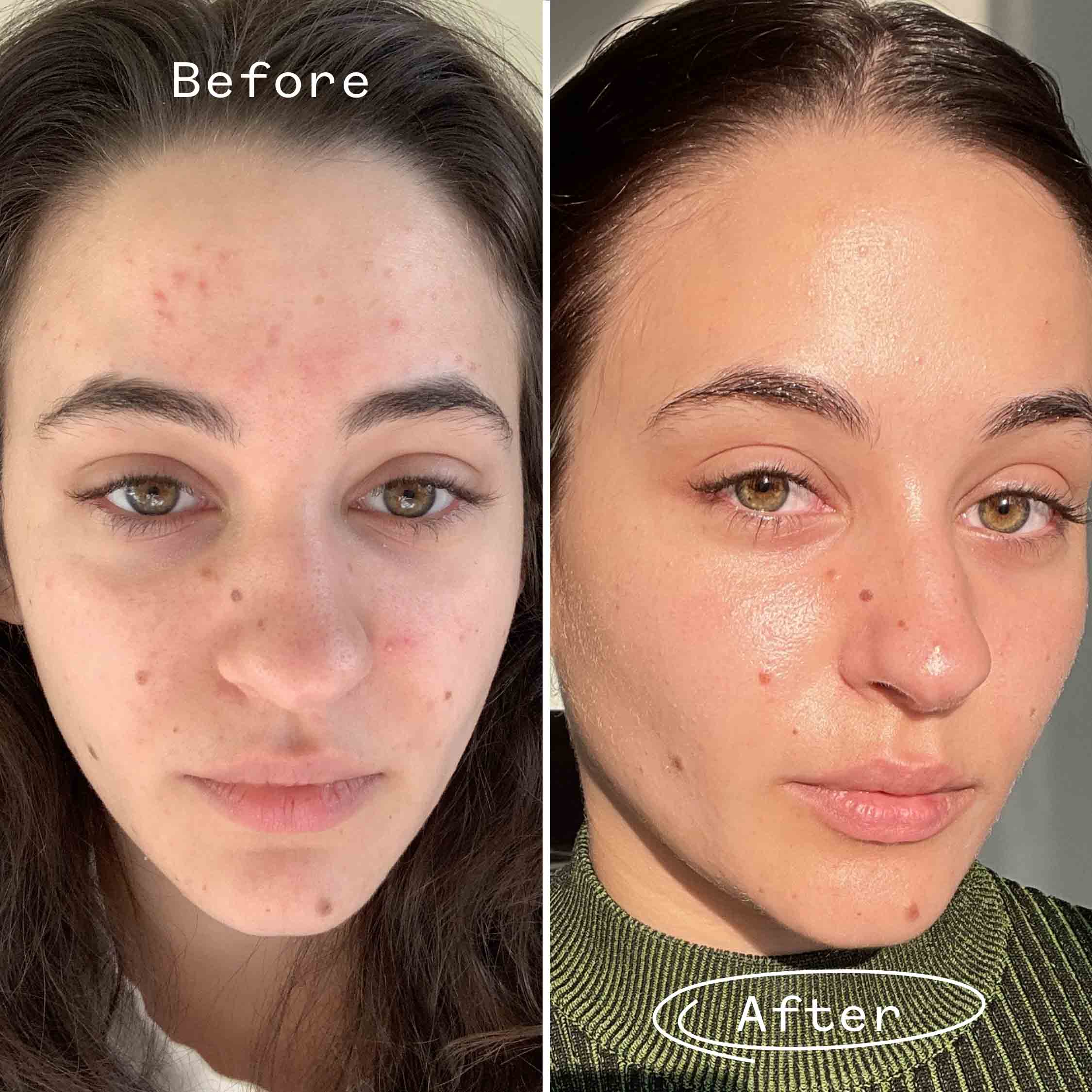 Carbon Star™ Face Oil - Image 4