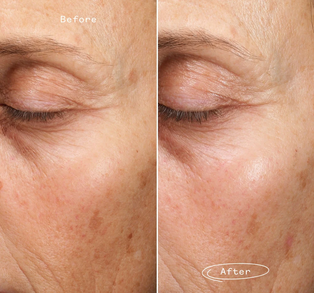 Fade Forward™ Serum - Image 5