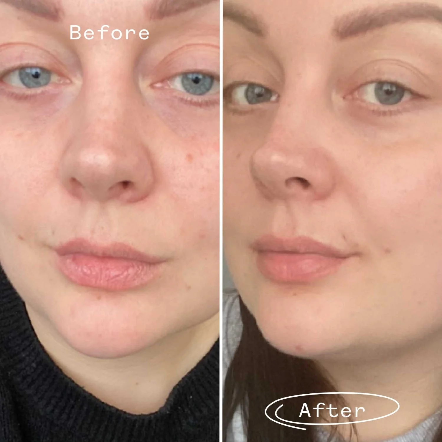 Rosehip Bioregenerate™ Face Oil Mini - Image 4