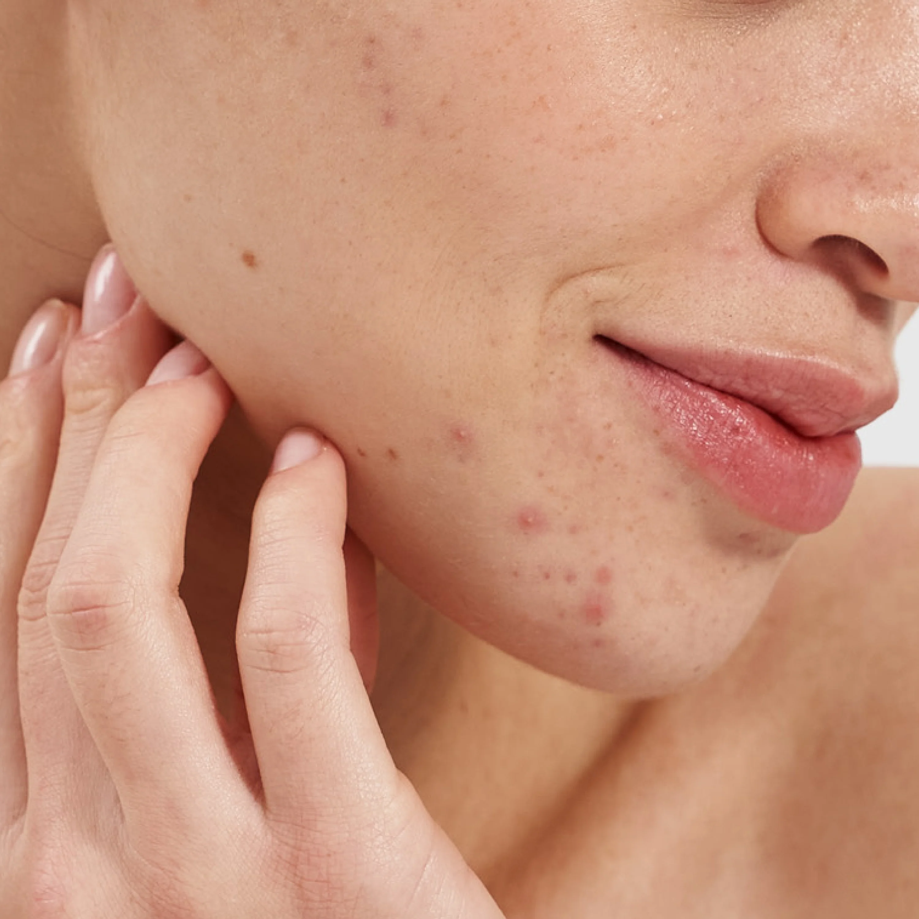 Salicylic Acid 2% Clarifying Booster - Image 7